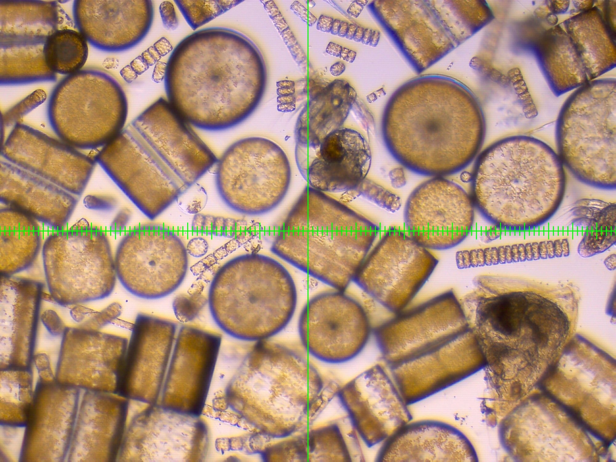 Plankton in Douglas Bay